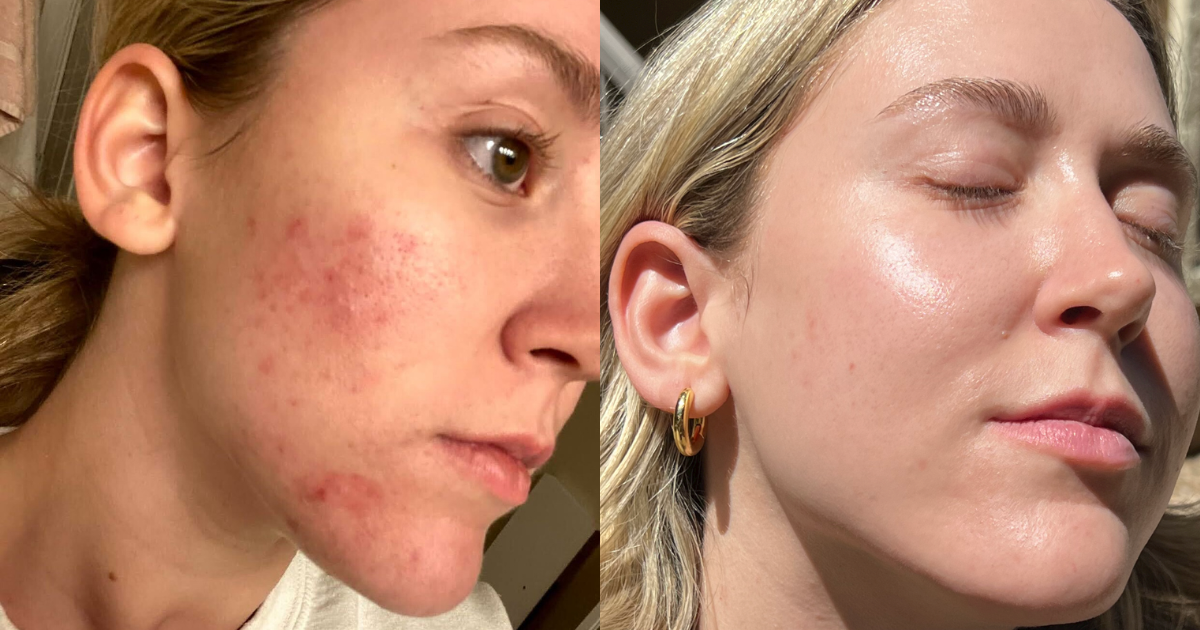 Hi Skin cover