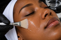 <p>Chemical <br/>Peels</p>