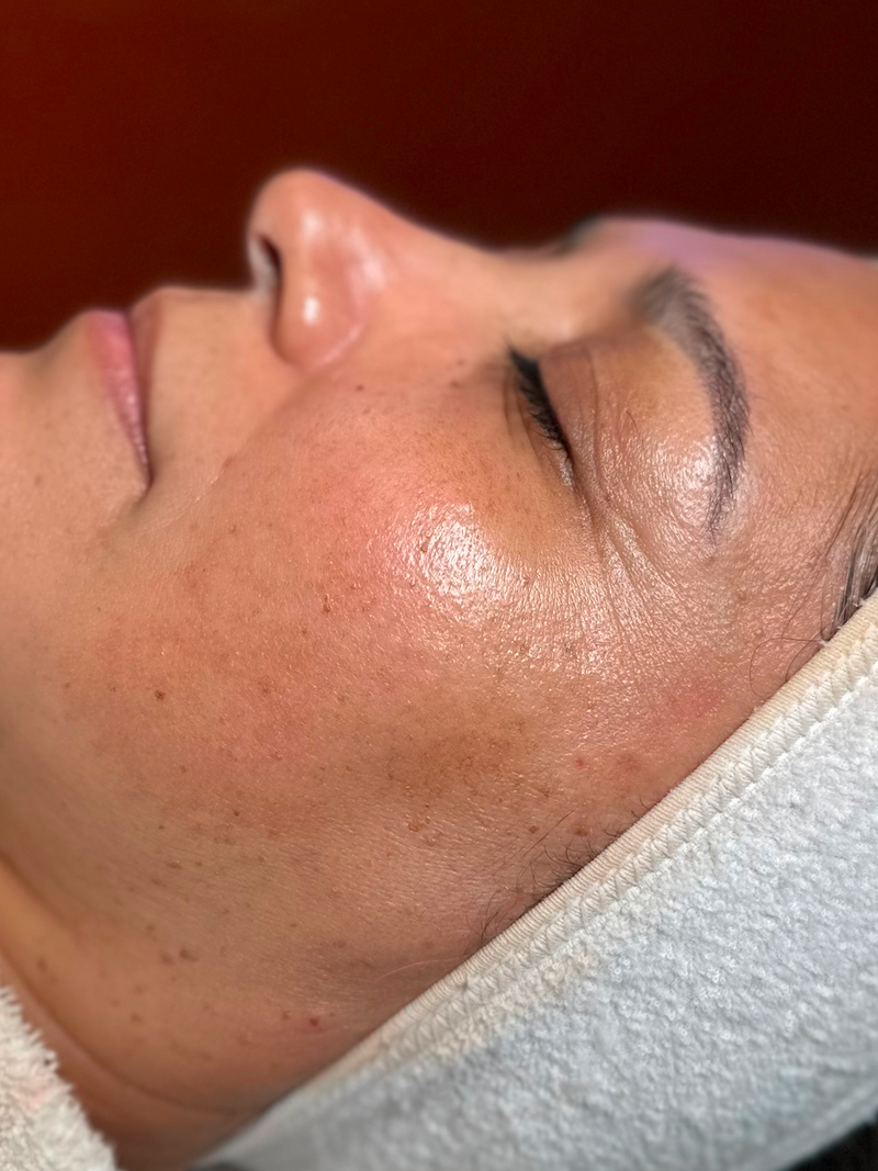 Dark Spots