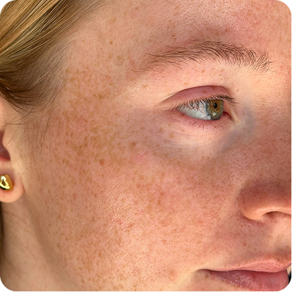 Start with your skin.