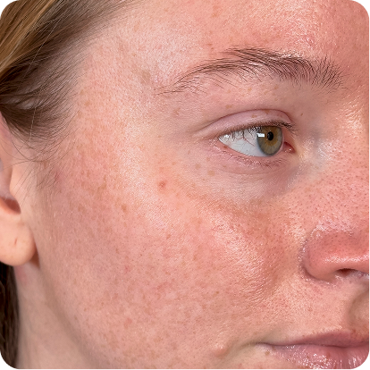See how your skin responds.