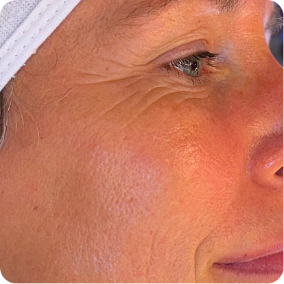 See how your skin responds.