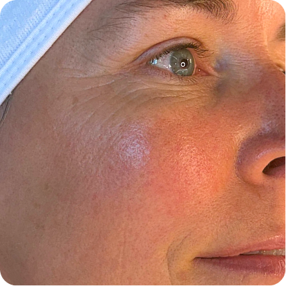 Start with your skin.