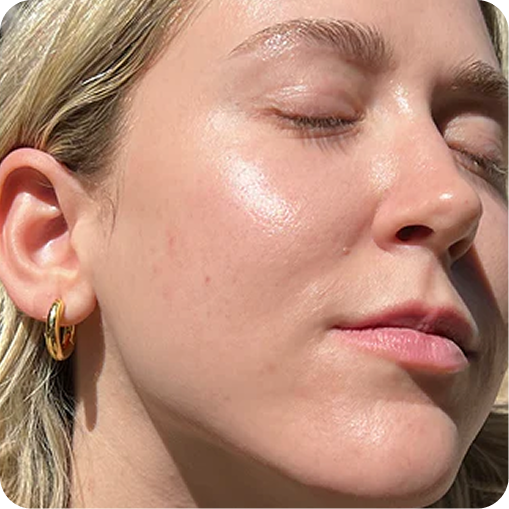 Hi Skin result1
