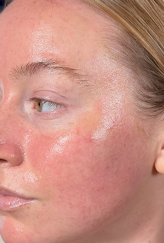 After Dark Spots