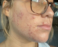 Hi Skin result badge