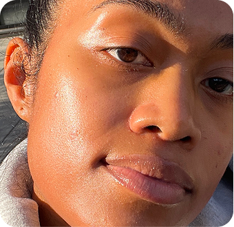 Hi Skin story 12