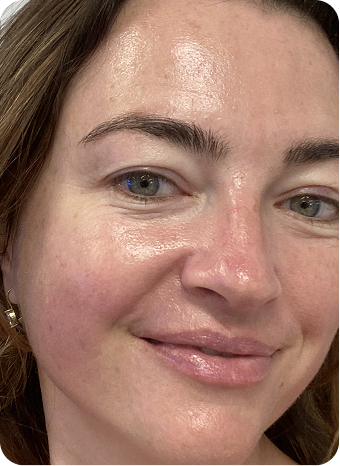 Hi Skin story 8