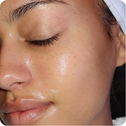 Breakouts