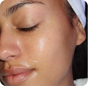 Hi Skin story 9