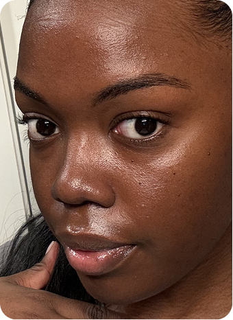 Hi Skin story 14