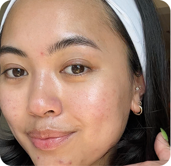 Hi Skin story 15