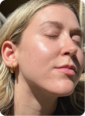 Hi Skin story 2
