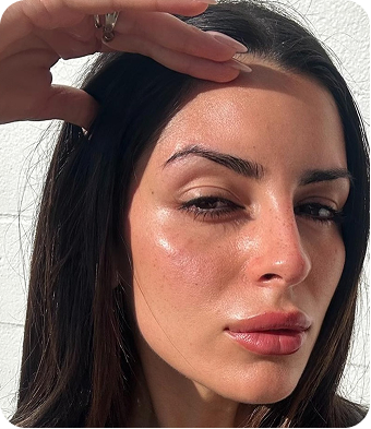 Hi Skin story 7