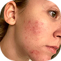 Hi Skin result badge