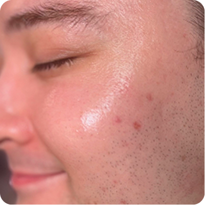 <p>See how your <br/>skin responds.</p>
