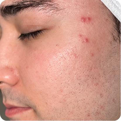 <p>Start with your skin.</p>