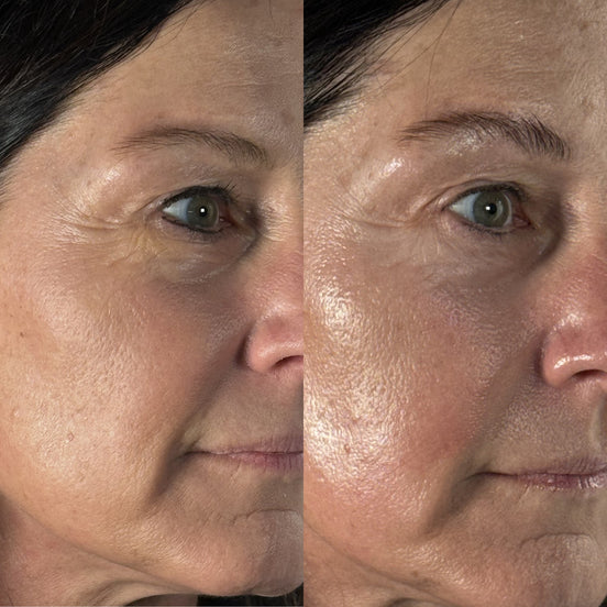 Anti-Aging Facial
            
